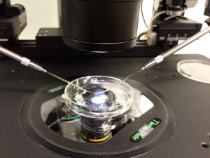 IVF 1